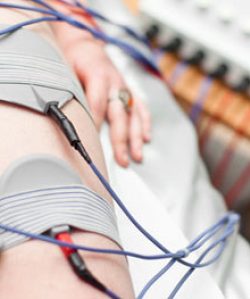 Elektroden eines Elektrotherapiegeräts sind mit Kabeln am Oberarm angelegt.